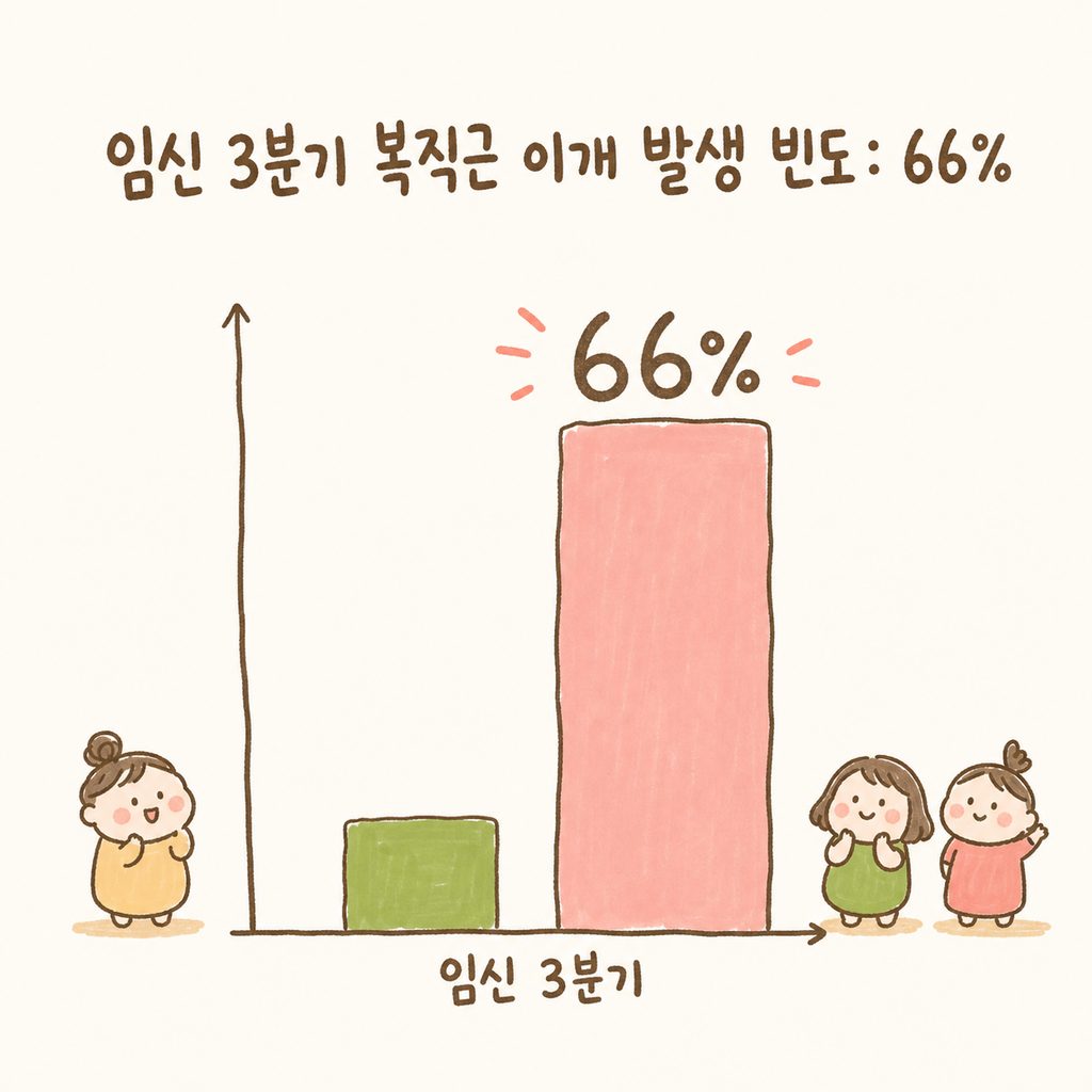 복직근 이개(DRA) 발생 빈도를 보여주는 단순한 막대 그래프. 임신 3분기 66% 수치를 강조하여 시각화