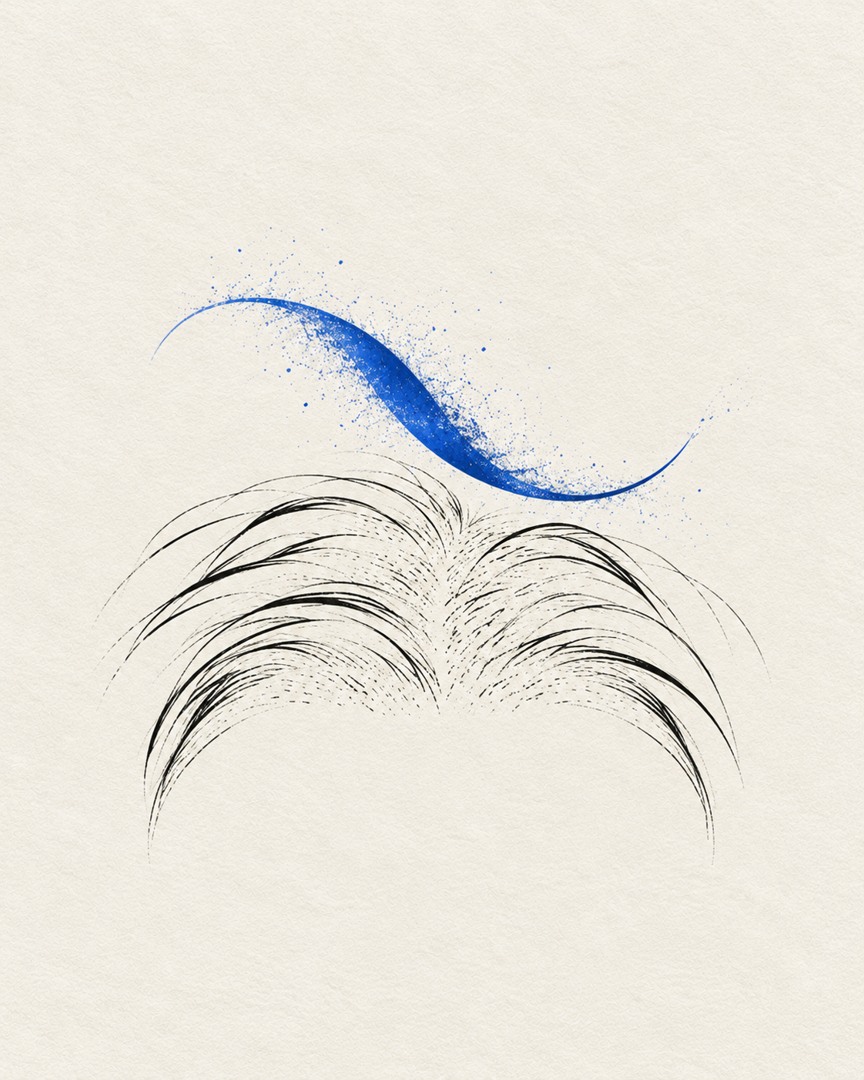 두피는 화끈거리는데 비듬은 적어요, 지루성두피염일까요?